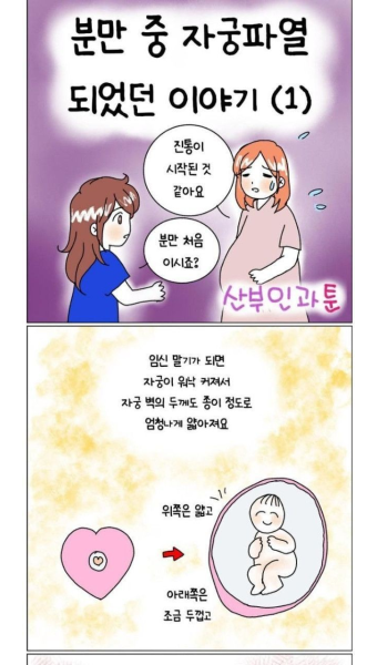 의사가 이해 못한 출산 전 자궁이 파열된 이유 의사가 이해 못한 출산 전 자궁이 파열된 이유 | 출산, 유머, 웃긴 밈