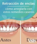 세종건축장수식이요법건강원 | Health에 관한 48개의 최상의 Pinterest 이미지 | 건강, 건강한 생활 및 자연요법 Health