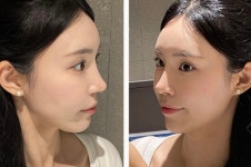 오엠성형외과의원