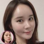 ❣ Lift up sagging facial lines into pretty V-lines! NANA will help you determine what types of procedures you need to achieve... 