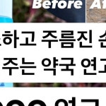 우리약사 | 배혜정 on Instagram: 나이 티 안나는 손 만들어주는 약국 <000 연고> 요즘 워낙 얼굴 관리 목관리는 잘하셔서 얼굴 봐도 나이를 도통... 