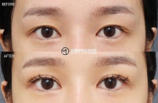 오엠성형외과의원