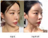 오엠성형외과의원