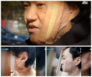 피해자가 무사해서 다행... 수원 묻지마 폭행당하던 여성 도와주다 50 바늘 꿰맨 부자