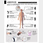 티칭지 디자인 #중풍후유증 #뇌졸중후유증 #티칭지 #의학 #메디컬일러스트 #캘리디자인 #병원 #의료기관 #한의원 #한방병원 #보건소 #진료티칭지