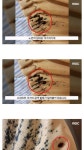 빈대 나왔다고 난리났던 계명대 기숙사 결말..