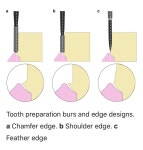 Dentistry에 있는 Neha님의 핀 | 치과