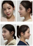 오엠성형외과의원