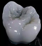 Pin by 화정유 on dental advanced | Dental art, Teeth art, Dental lab