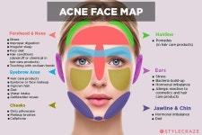 You May Enjoy natural skincare By Using These Helpful Suggestions - 2020 | 에센셜 오일 블렌드, 피부관리, 여드름 흉터