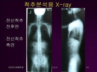 몸의 중심, 전후의 중심은? body center 김수범 건컬럼 푸드투데이 우리몸의 중심은 어디일까? 많은 학자들은 여러 곳에 몸의... 
