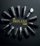 기공에 있는 010-2446-3754님의 핀(이미지 포함) | 치과