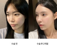 오엠성형외과의원