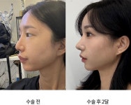 오엠성형외과의원