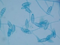Fungi에 관한 11개의 최상의 Pinterest 이미지 | 미생물학, 래브라도 및 간호 Fungi