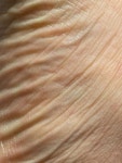 Pin page Pin by Stella, ✷ on 쓰레기통 | Body photography, Skin, Human body