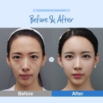 Before and after에 있는 핀