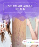 하지정맥류를 예방하는 6가지 팁 — 건강을 위한 발걸음 | 대체의학, 건강, 운동