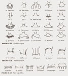 Resultado de imagen para types of sleeves on blouses | 패션 용어