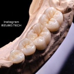 Pin de roona Lely em 스터디 자료 em 2020 | Odontologia, Prótese dentária, Dentes