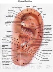 Acupressure Therapy에 있는 핀