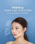 윤곽수술의 정석