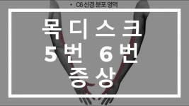 목디스크 5번 6번 증상 | 자료실