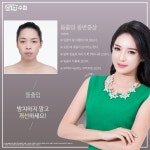 바노바기 성형외과 시원하게 알려드릴게요~! #안면윤곽, #양악수술, #돌출입, #교정, #koreaplasticsurgery, #바노바기성... 