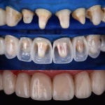 Dental에 있는 핀