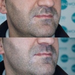 길희 이님이 일러스트레이션에 올린 이미지 | 탈모, 눈썹, 눈