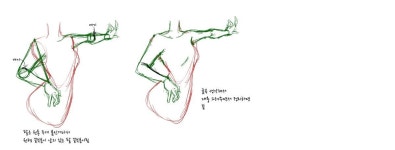 인체에 있는 핀