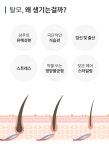 박미순두피클리닉 | ⭐특허⭐매일 13원에 두피클리닉 하세요 가성비 혁신템 | 탈모 치료, 웹디자인