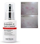 [베리코스 레드포인트-엑스 스팟컨트롤 - vericos redpoint X spot control] 민감성 피부를 위한 집중진정케어 + 천연식물성분84%이상 함유... 