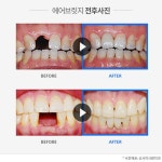 신사이사랑치과 | 남자 패션, 패션, 건강 팁
