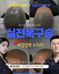 탈모연구소_몽드랩 달킨 - YouTube 탈모연구소_몽드랩 달킨