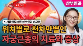 서울성모병원 산부인과 송재연 - YouTube 위치별로 천차만별인 자궁근종의 치료와 증상 / 서울성모병원 산부인과 송재연