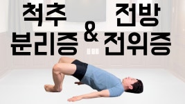 네이버 인플루언서 [네이버 인플루언서] 척추분리증과 전방전위증은 허리 운동만으로 완치되지 않습니다. 고관절 운동을 반드시 함께 해야 합니다.