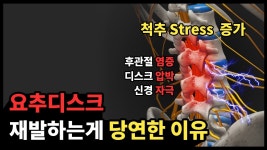 네이버 인플루언서 [네이버 인플루언서] 허리 골반 통증이 해결되지 않는 이유