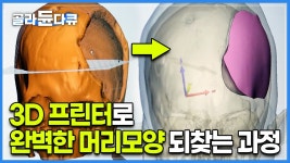 이걸로 두개골 축소 못하나? - 대두 마이너 갤러리