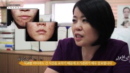 미앤아이 한의원 이영미 원장님이 말하는 여드름·여드름흉터 치료 | Doovi 미앤아이 한의원 이영미 원장님이 말하는 여드름·여드름흉터 치료