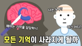 네이버 인플루언서 [네이버 인플루언서] 해마를 제거하면 어떻게 될까