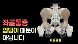 네이버 인플루언서 [네이버 인플루언서] 치료해도 아픈 좌골통증, 코어 안정성이 답입니다