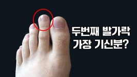 두번째 발가락이 더 길면 병이라는 유튜버 발음들어봐 - 메르스 갤러리