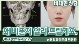 네이버 인플루언서 [네이버 인플루언서] 왜 삐뚠지 알려 드릴게요. [비대면상담 363] / Ill tell you why its crooked.