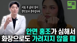 네이버 인플루언서 [네이버 인플루언서] 닥터봄의원 피부과의 안면홍조치료법