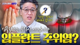 네이버 인플루언서 [네이버 인플루언서] 임플란트 관리 안 하면 생기는 충격적 결과💀 – [올쏘의 아싸 시즌3] EP40