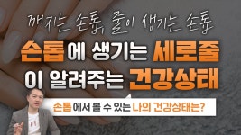 네이버 인플루언서 [네이버 인플루언서] 닥터지노의 손톱건강