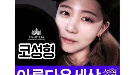 {아름다운세상성형외과] 코성형 전후사진 | Doovi {아름다운세상성형외과] 코성형 전후사진