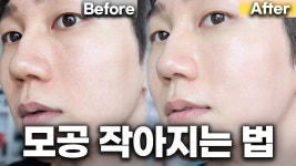 네이버 인플루언서 [네이버 인플루언서] 딱 1주일 걸렸습니다. 피부과에서 20만원 넘는 모공 관리, 집에서 하는 법