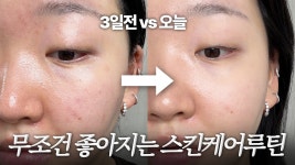 네이버 인플루언서 [네이버 인플루언서] 3일만의 급속진정루틴🔥피부 무조건 좋아지는 수부지/여드름/민감성의 나이트🌛스킨케어루틴✨성분...
